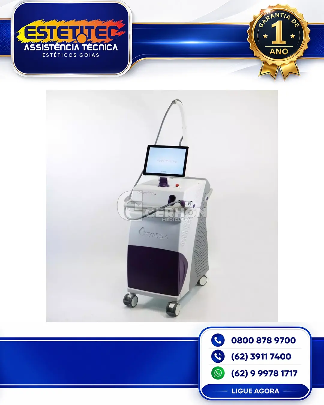 SUPORTE TÉCNICO PARA CANDELA VBEAM PRIMA SANTA CATARINA